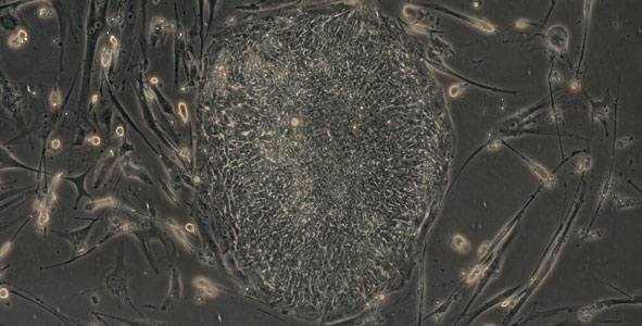 iPS Cell