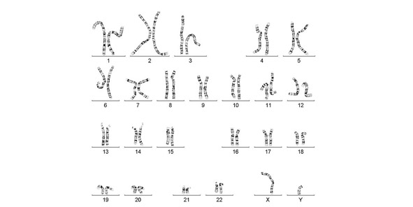 Chromosomes.