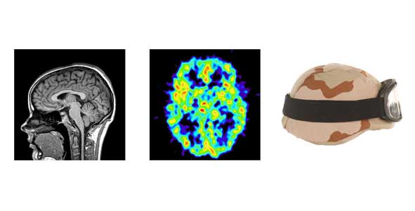 MRI scan, PET scan, army helmet