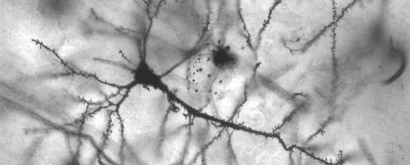 Neuron
